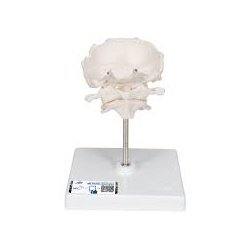 Atlas Axis And Occipital Bone Model