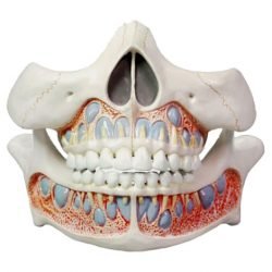 Lumbar Spinal Column With Sacral And Coccyx Bones