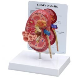 Human Pathology Models