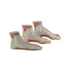 Normal And Abnormal Feet