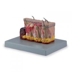 Pathological Model Of Burned Skin