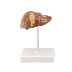 Pathological Model Of The Human Liver