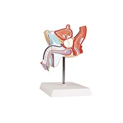 Pathological Model Of The Male Urogenital System