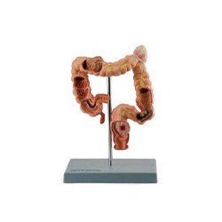 Pathological Model Of The Rectum